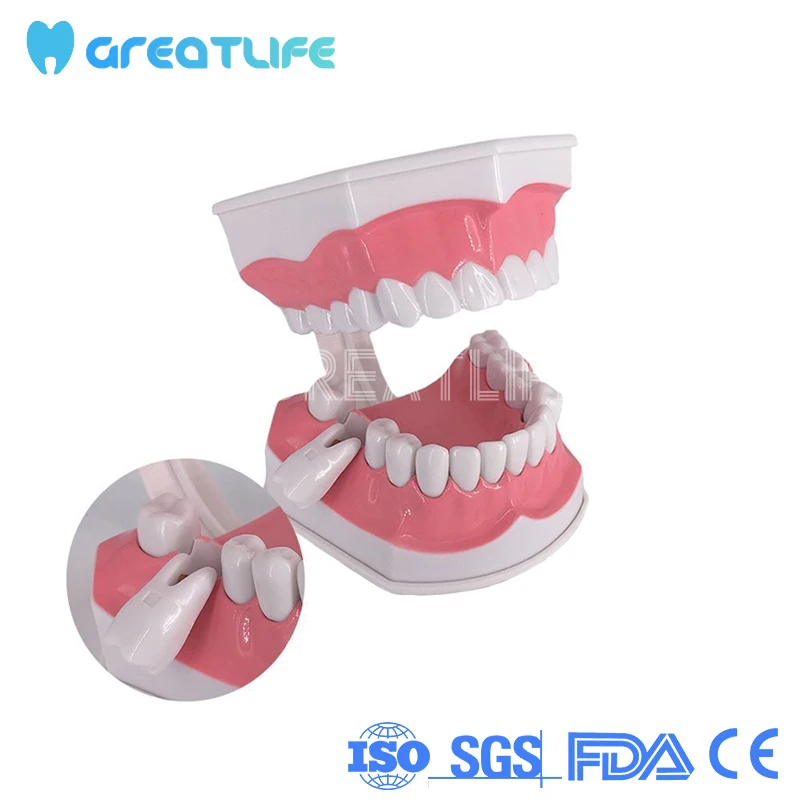 

Large 1:2 Teaching Study Brushing Tooth Model Tools Removable Teeth Model with Removable Lower Teeth for Kids Oral Care Teaching