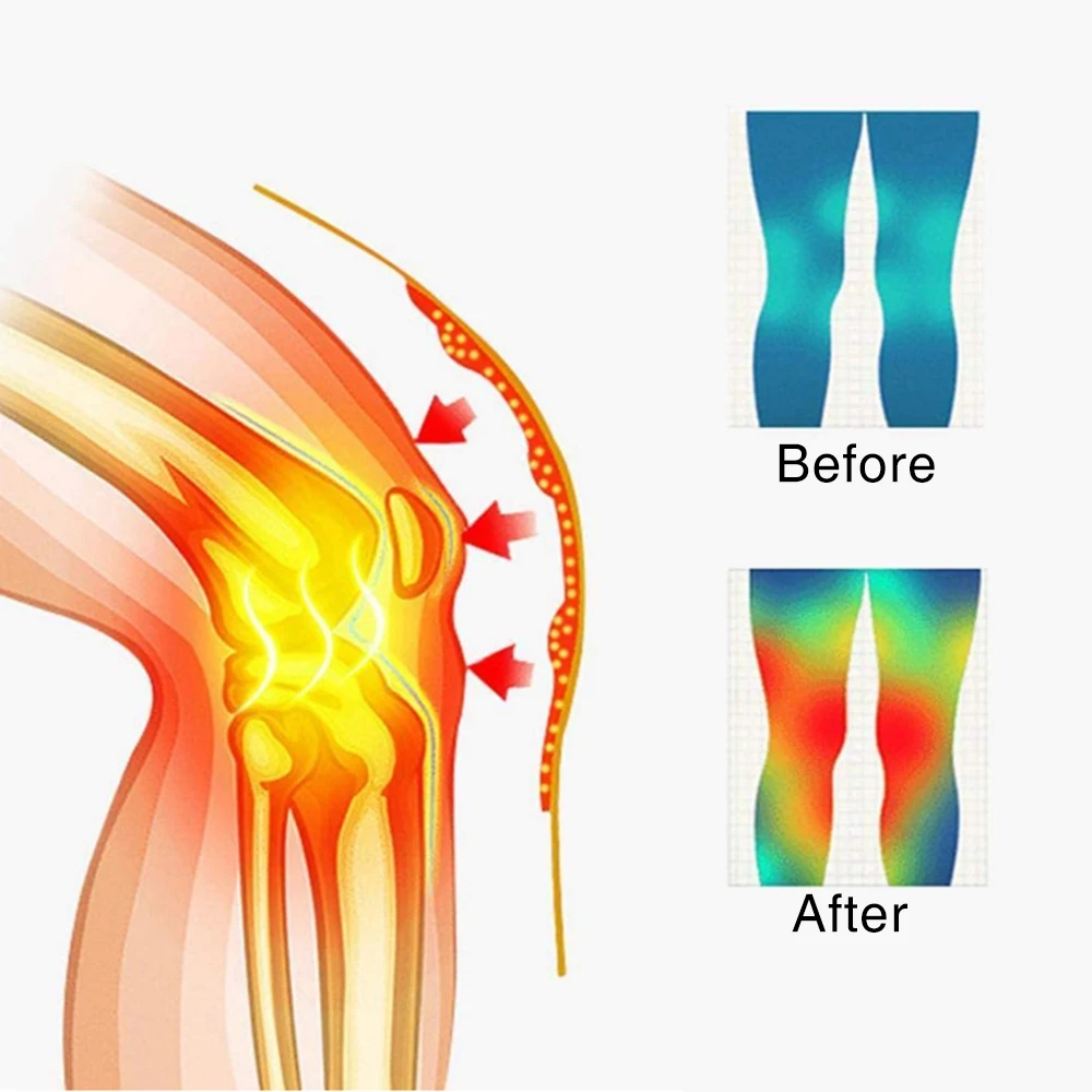 2PCS New Self Heating Knee Braces Sleeve Tourmaline Arthritis Knee Support Tourmaline Magnetic Keep Warm Knee Pads