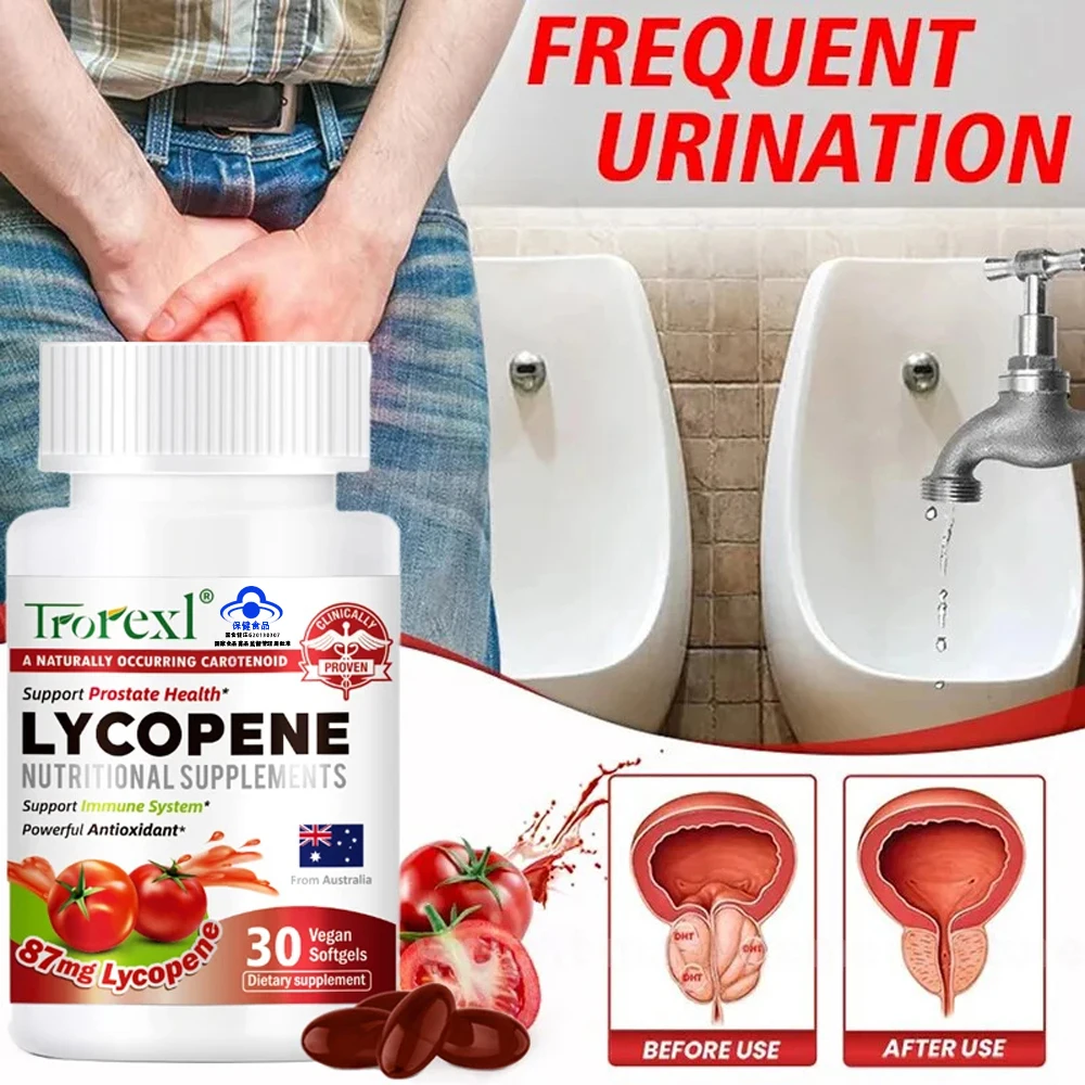 Trorexl 30 capsules/bottle Lycopene capsules, prostate treatment capsules, improve immunity and urinary tract health