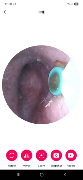 Smart Visual Ear Cleaner HD Ear Sticks Otoscope USB C Charging Endoscope Wax Removal Tool Earpick MIni Camera Health Care Set photo review