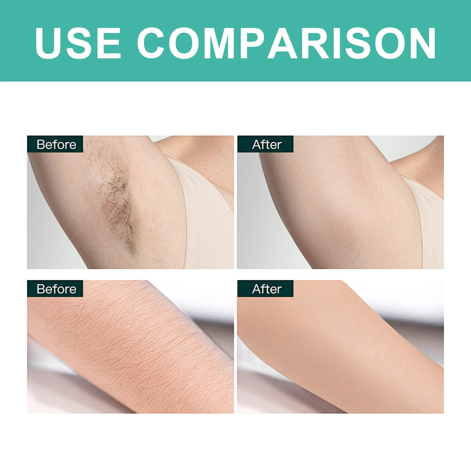 Eelhoe Waxing Paper Skin Moisturizing Whole Body Arm Underarm Thigh Hair Universal Rapid Hair Removal Mild And Non-irritating