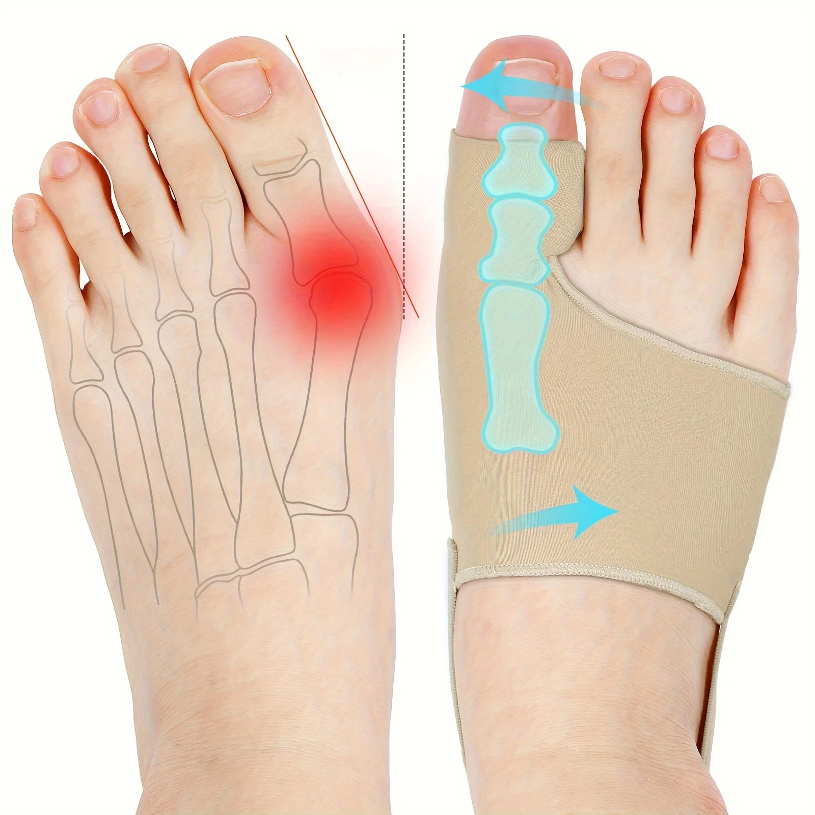 Tech Love Bunion Corrector For Women Men Big Toe 1 Pair, Adjustable Bunion Splint With 2 Angle Bar, Pads