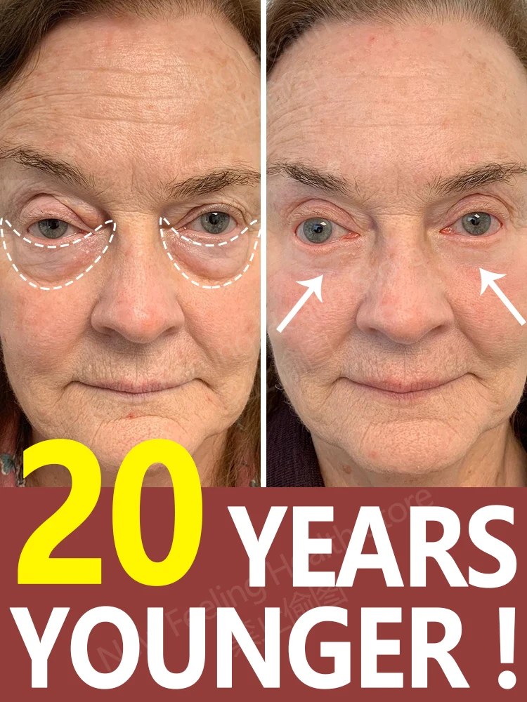 

Eye cream Remove bags Puffiness away work under eyes