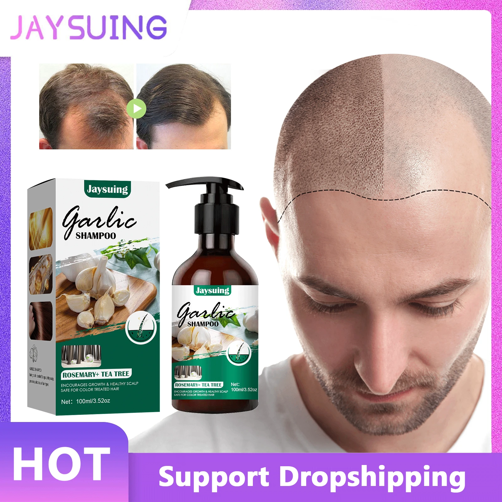 Jaysuing Garlic Hair Growth Shampoo Effective Anti Hair Loss Treatment  Thinning Hair Growth Liquid Anti Itching Dandruff Shampoo| | - AliExpress