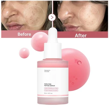 Siero al collagene peptidico Rimuovi l'essenza dell'acne Migliora l'illuminazione della pelle Fornire idratazione profonda Leviga la struttura della pelle Prodotti coreani