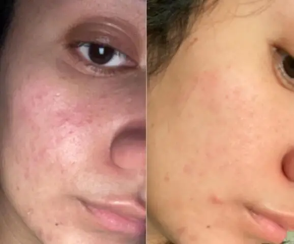 day-whitening-cream-