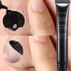 Unisex Blackhead Peeling Mask Deep Cleansing Oil-Control Beauty Skin Care Face Black Mask Acne Treatment Blackhead Remove Makeup 1