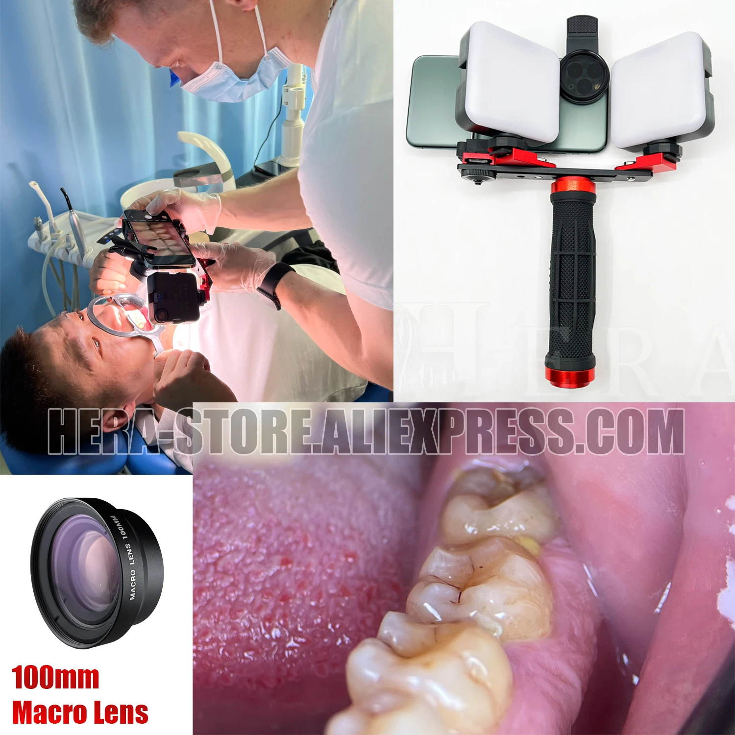 Dentiphoto Best Camera Phone For Dental Photography Dental