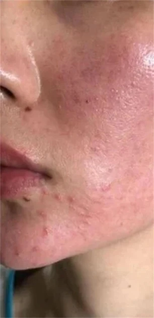 Turmeric & Kojic Acid Cleansing Pads