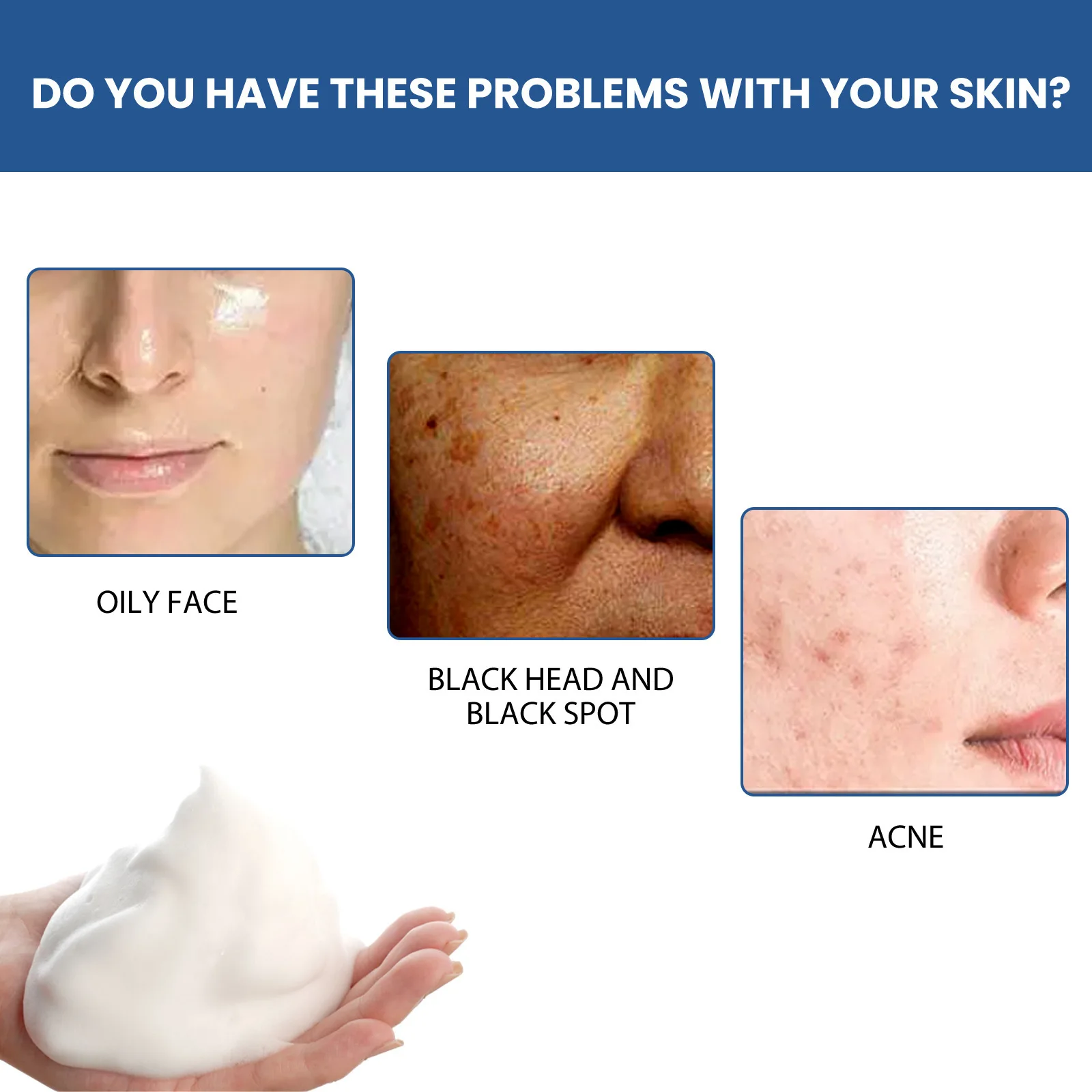EELHOE Freckle Removing Facial Cleanser Oil Control Deep Cleansing Pores Lightening Dark Spots Acne Treatment Skin Moisturizing 4