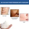 EELHOE Freckle Removing Facial Cleanser Oil Control Deep Cleansing Pores Lightening Dark Spots Acne Treatment Skin Moisturizing 4