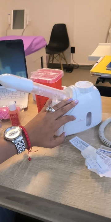 IBeautyi® Ozone Facial Steamer for 3x Ultimate Clearer Skin photo review