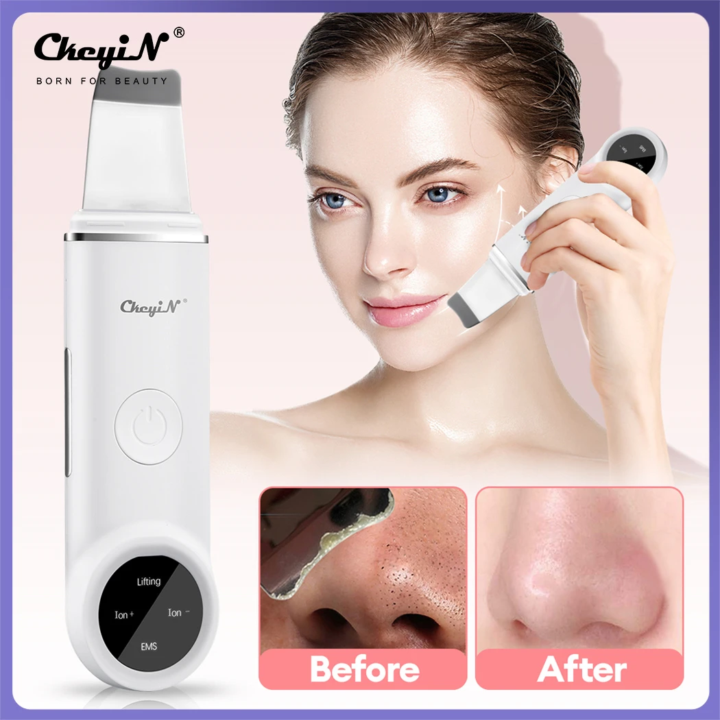 CkeyiN Ultrasonic Skin Scrubber 24000HZ EMS Ion Vibration Face Peeling