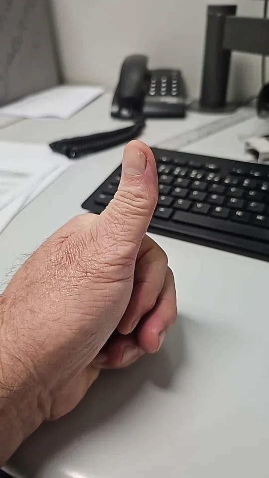 NEVERDIE STORE - Lanterna Led Prova Dágua 4 Núcleos Potente Usb Recarregável ENVIO RAPIDO PARA TODO O BRASIL photo review