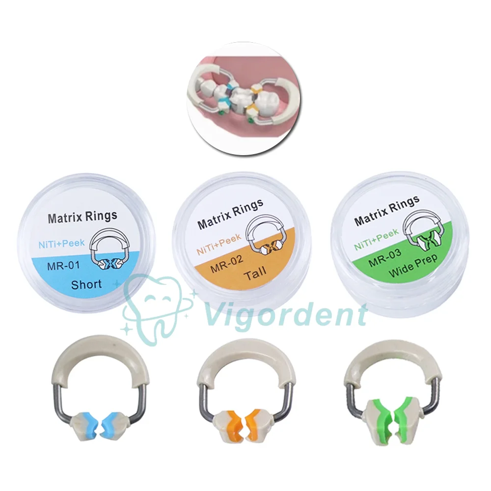 1 Stück Vigordent Dental-Matrizenbänder NITI Klemmring für Metallmatrizen, Sektionale Konturierte Klemm-Matrizen, NiTi Clip Matrizen-System-Kit