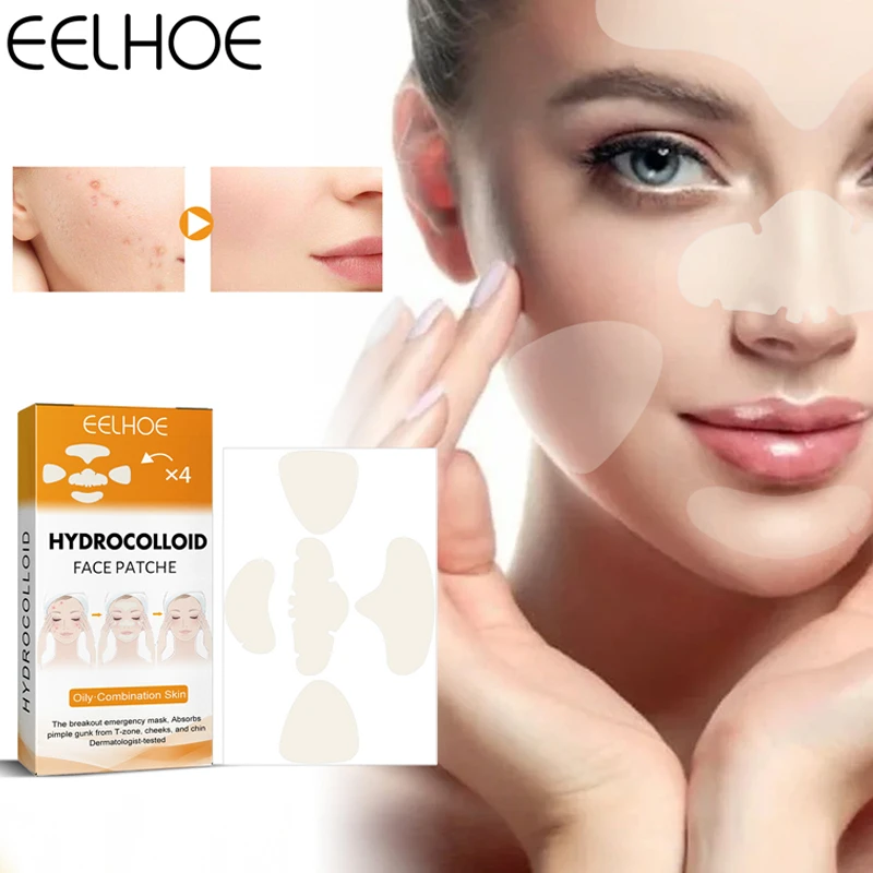 uitbreiden Bederven Perth Xl hydrocolloïde acne gezichtsmasker 5 grote puistjes voor puistjes puistjes  op neus, kin, voorhoofd en wangen| | - AliExpress