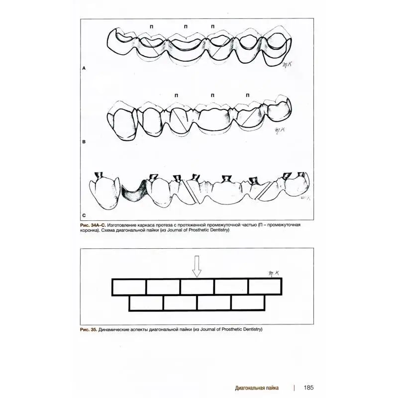Рисунок 6 - Книга Металлокерамические реставрации