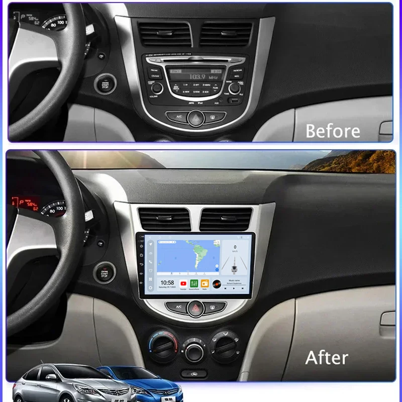 Car Stereo Acodo For Hyundai Accent 2010 - 2017 Android 12 Player with Frame Plug and Play QLED Screen Carplay FM WIFI BT Radio