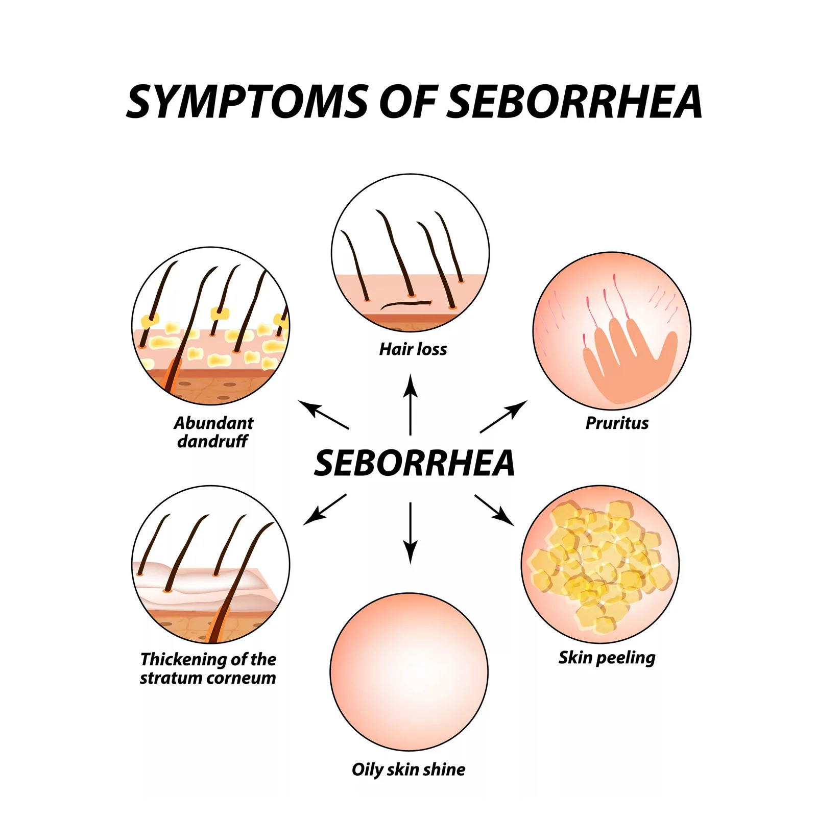 Seborrheic Dermatitis Cream Skin Care Treat Psoriasis Eczema Repair Scalp Relieve Itching Remove Dandruff Healthy Skin Ointment