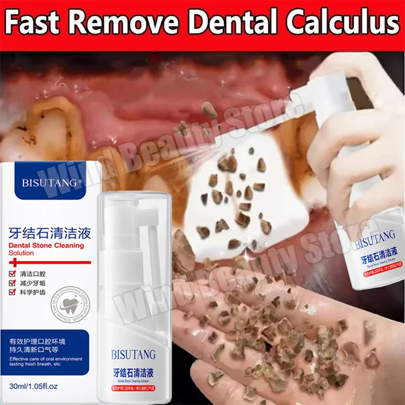 Dental Calculus Remover Teeth Whitening Spray Toothpaste Cleaning Oral Hygiene Removal Halitosis Plaque Stains Fresh Breath Care dental calculus remover