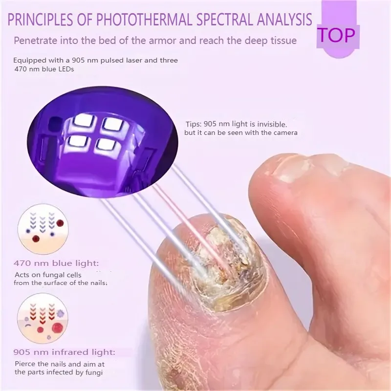 Pink Nail Fungus Treatment Device 905nmlnfrared light 470nm Blue light UsBcharge Nail Fungus Laser Foot Carerelaxation