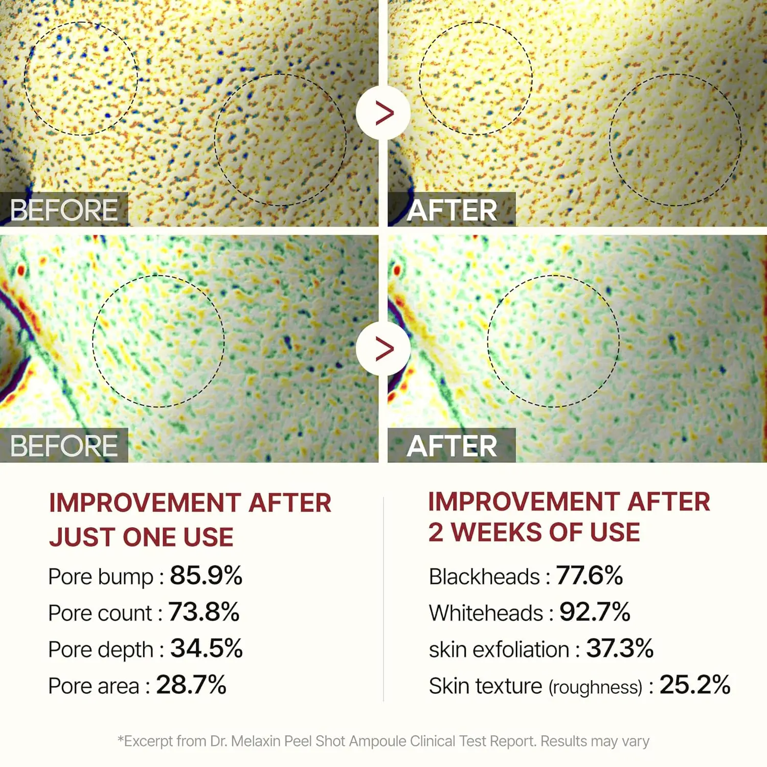 Rice Peeling Ampoule Peel Shot Glow product image 7