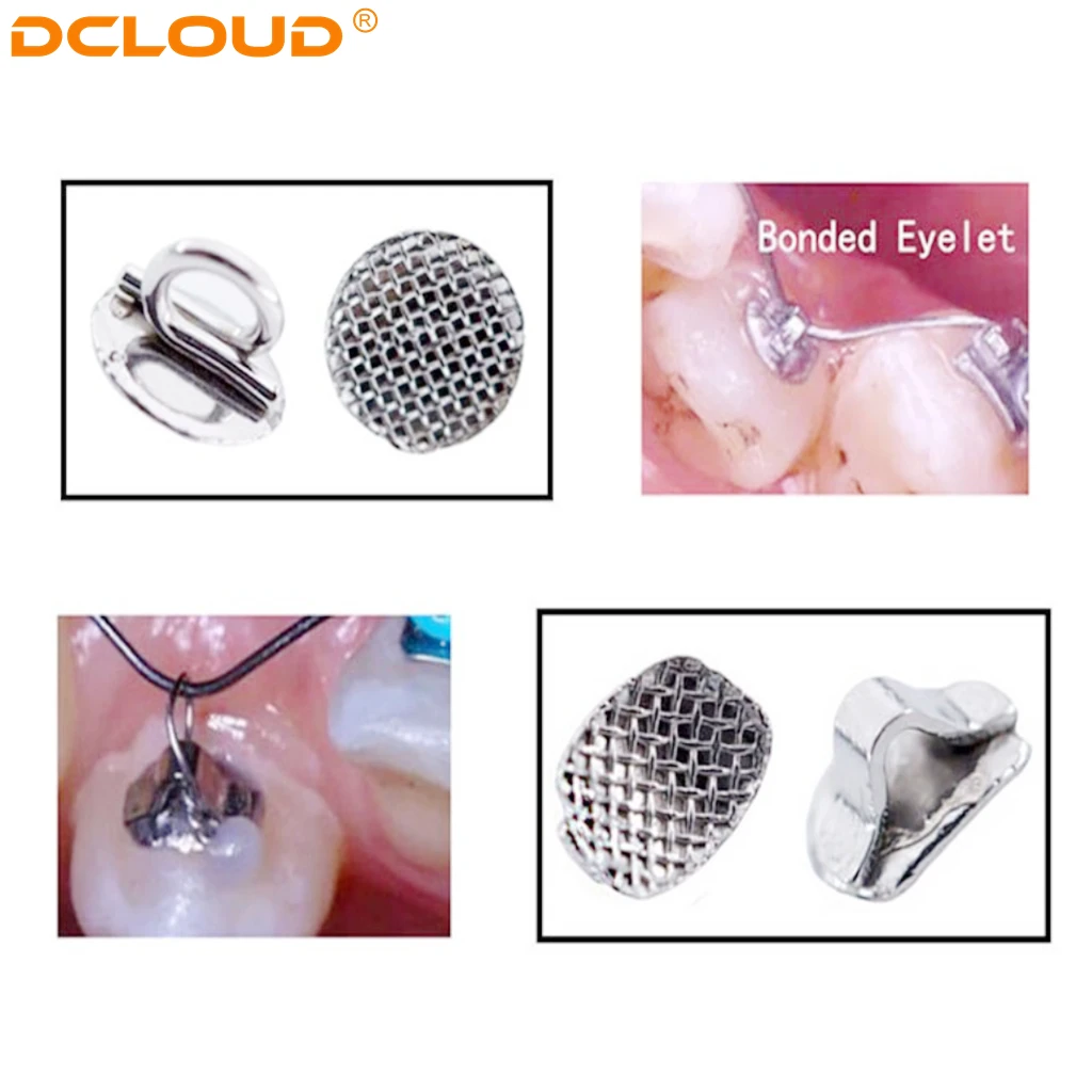 100 Pcs Dental Orthodontic Bite Turbos Opener Tongue Tamers Bondable Hinge - Foto 4