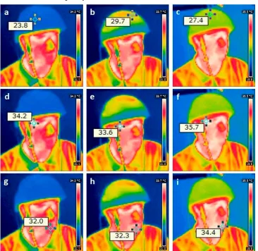 1070nm Led Helmet Natural Treatment for Stroke Parkinson Alzheimer Depression Infrared Light Brain Photobiomodulation