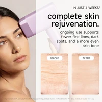 MLAY T14 épilateur laser malais épilation originale IPL Machine permanente dispositif d'épilation pour visage corps femme épilateur à domicile 4