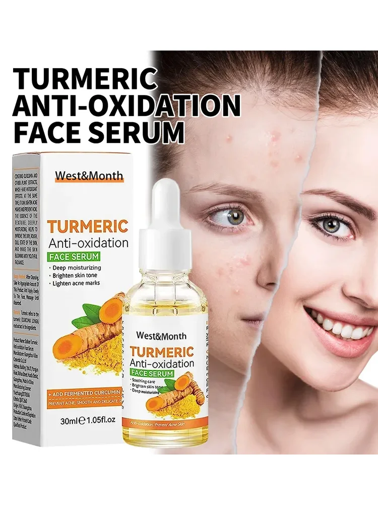 Turmeric Anti-Freckle Essence Vitamin C Face Serum Whitening Acne Treatment Moisturizing Facial Essence Unisex Skin Care
