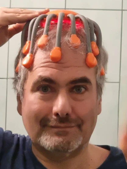 OctoRelax – Dein Kopfhaut-Massagegerät photo review