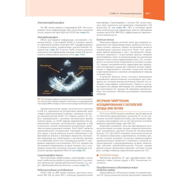 Рисунок 6 - Кардиология по Херсту В 3 т. под ред. В. Фустера