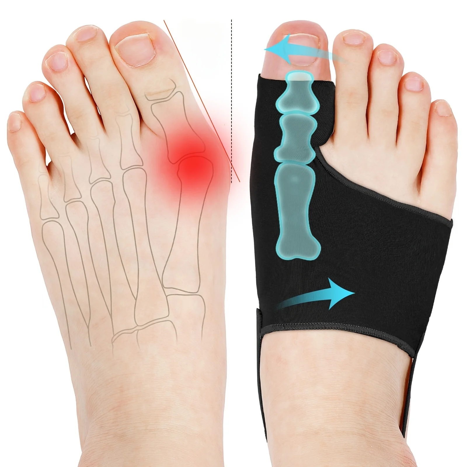 Tech Love Bunion Corrector For Women Men Big Toe 1 Pair, Adjustable Bunion Splint With 2 Angle Bar, Pads