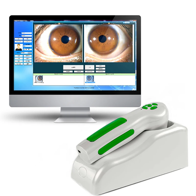 Diagnostic Eye Camera 12MP HD 30x Iris Lens and Driver-Free Analysis Software High Resolution CCD USB Iriscope 3