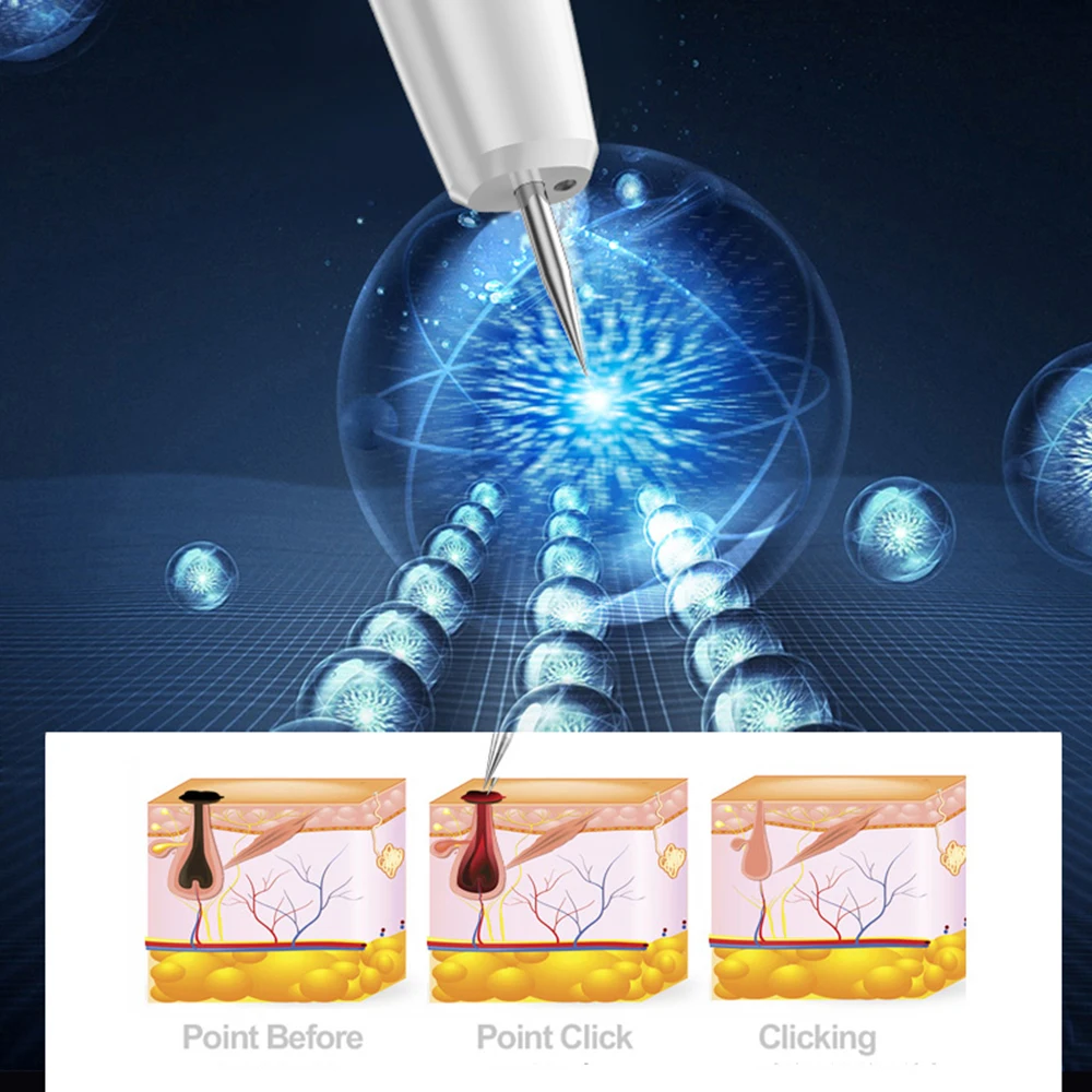 Laser Plasma Pen for Skin Tag Remover Freckle Black Dot Papilloma Warts Mole Pimples Tattoo Removal Laser Pen Beauty Care Tools
