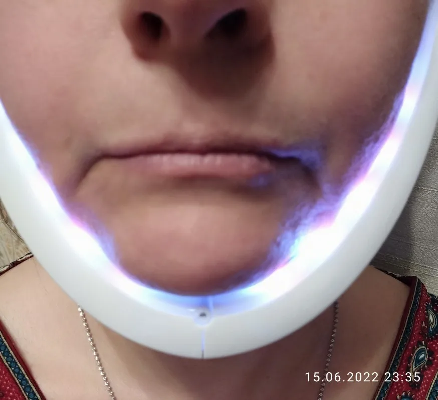 Microcurrent Jowls Slimmer Facial Shaper Wonder Massager