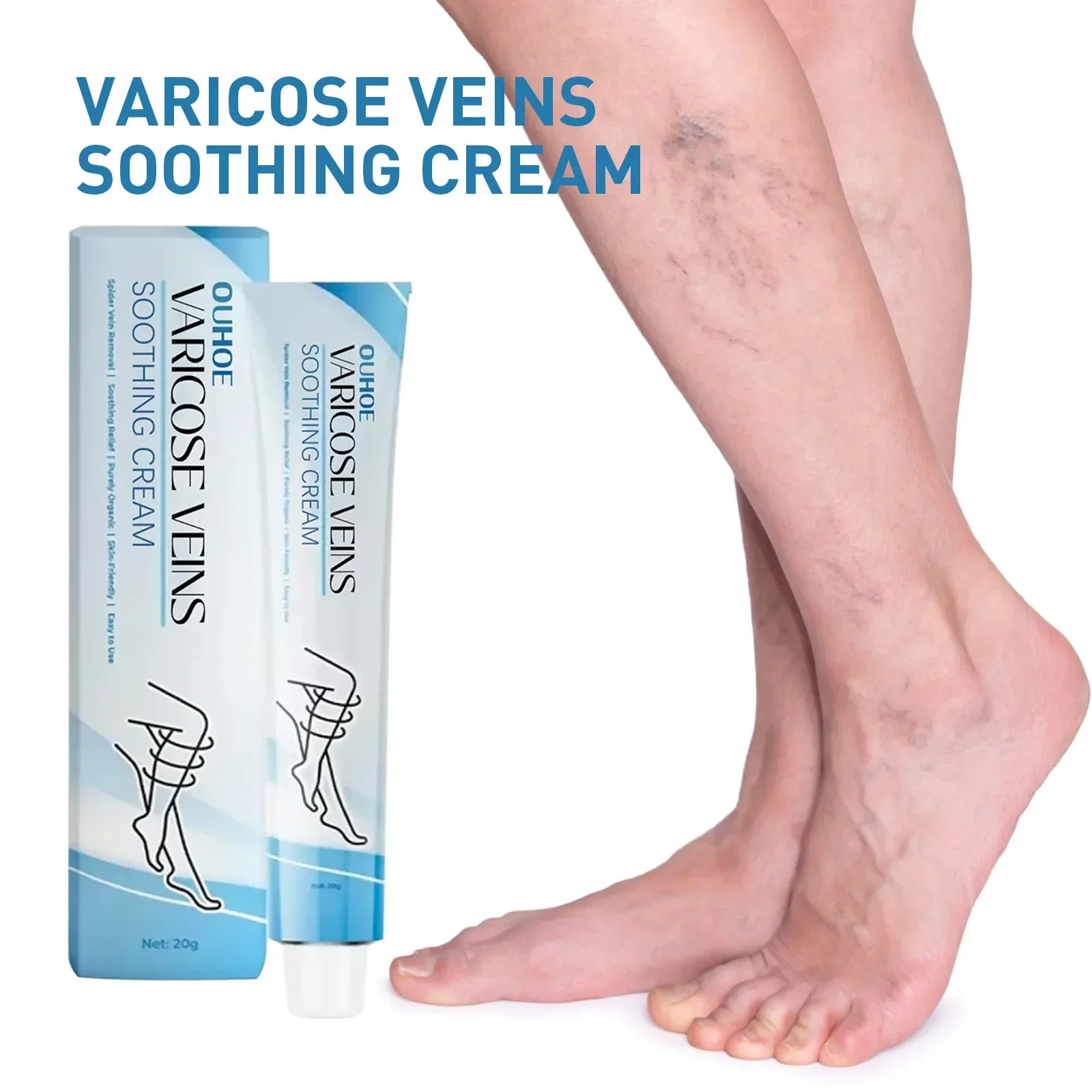 Crema per alleviare la vasculite, flebite, vermi, ragni, zampe, dolore ai vasi sanguigni, lenitivo, riduzione del gonfiore, unguento per alleviare le vene varicose_voghion.com