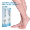 Relieve Vasculitis Cream Phlebitis Worm Spider Legs Vessel Pain Treatment Soothing Reduce Swelling Varicose Vein Relief Ointment 4