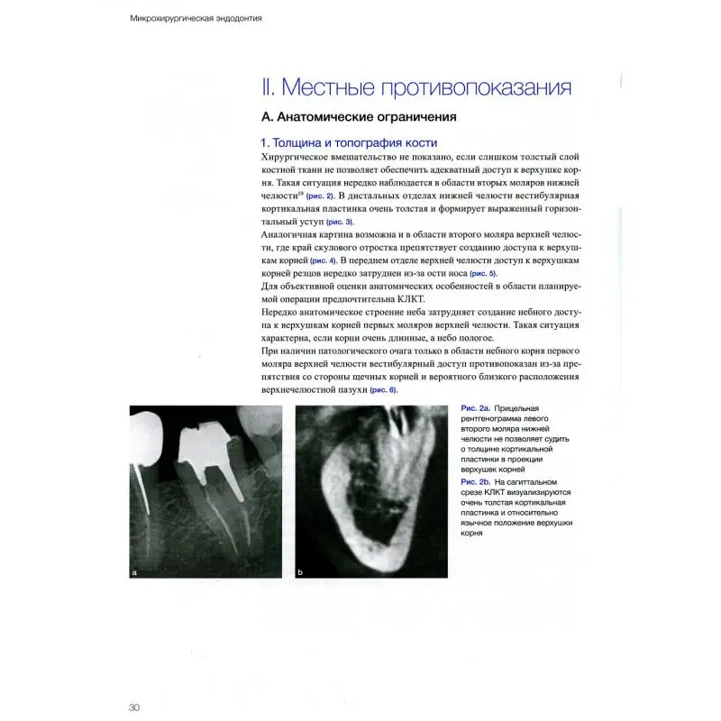 Рисунок 5 - Книга Микрохирургическая эндодонтия Хаят Бертран