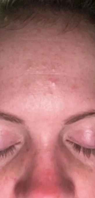 Turmeric & Kojic Acid Cleansing Pads