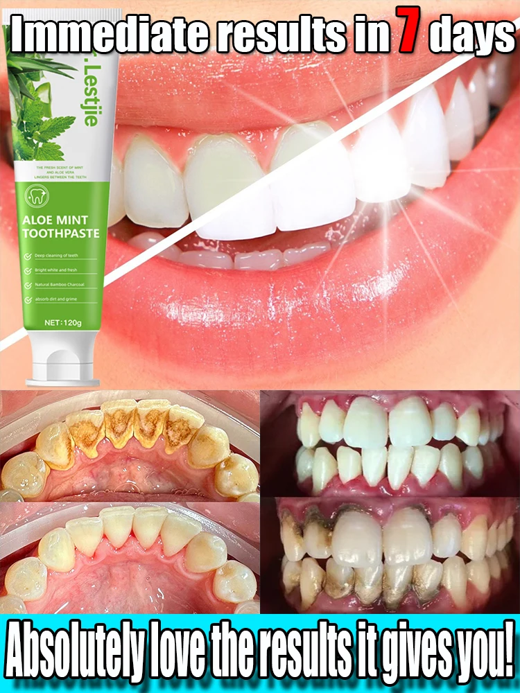 Teeth whitening toothpaste Remove calculus Oral odor Remove bad breath Prevent periodontitis probiotic oral whitening toothpaste removes bad breath dental plaque stains protects teeth and cleans teeth with fresh breath