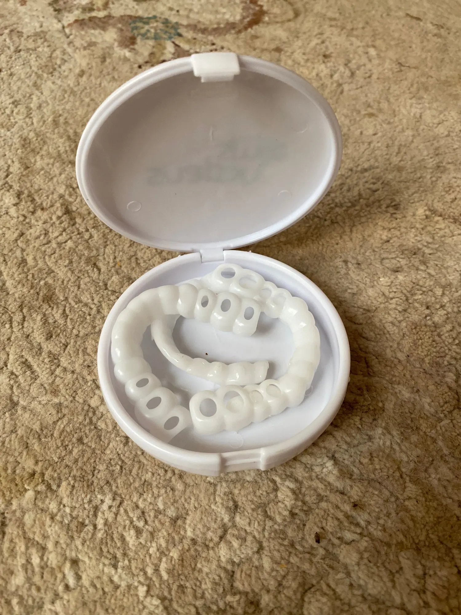 Snap-On Smile Teeth Veneers photo review