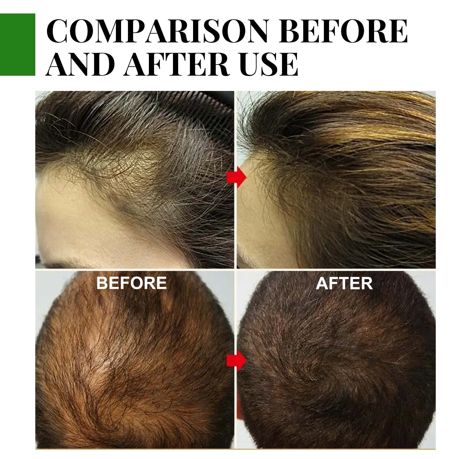 Eelhoe Rosemary Hair Care Capsule Hair Care Nourishes Roots Prevents Loss And Moisturizes Essential Oil