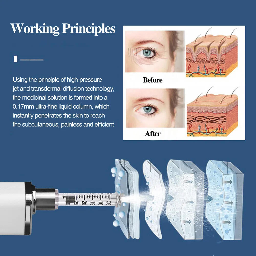 Electric 0.3ml Auto Hyaluron Pen Lip Injection with High Pressure Hyaluronic Acid Pen Beauty Injector Removal Wrinkle Anti Aging
