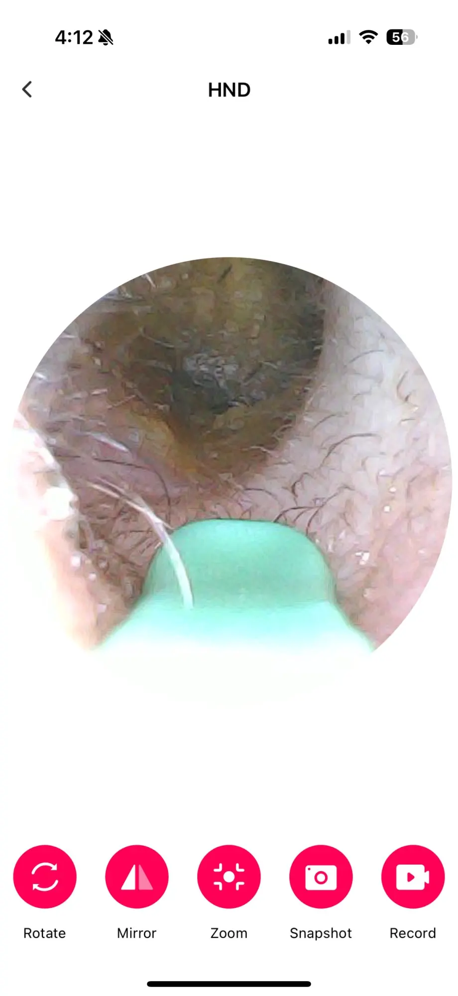 ClearEar™ - Safe Ear Cleaner for Kids & Families