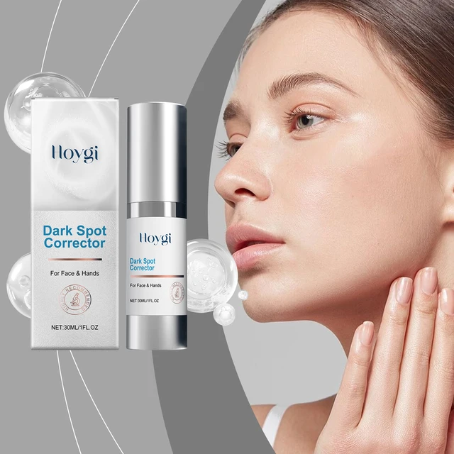Hoygi 30 ml Creme zur Reparatur dunkler Flecken, nährt das Gesicht, entfernt Melanin, gleichmäßige Hautverjüngung, verbessert Stumpfheit und erhellt die Gesichtslotion