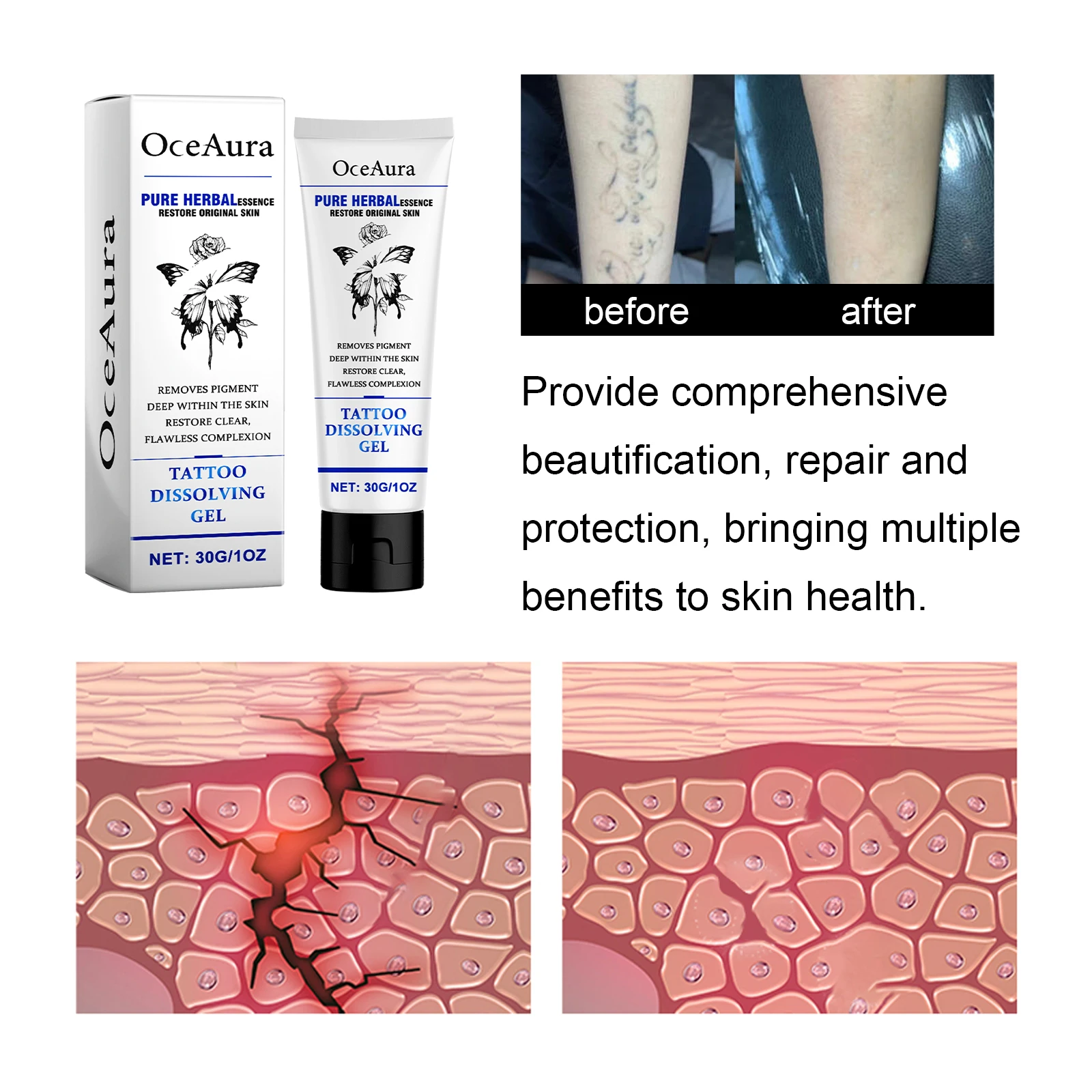 Oceaura Herbal Tattoo Remove Gel 3