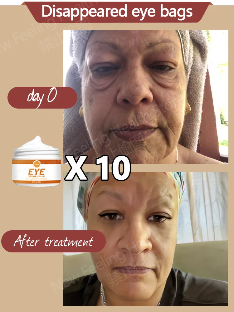 Remove bags Puffiness away work under eyes 3