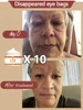 Remove bags Puffiness away work under eyes 3