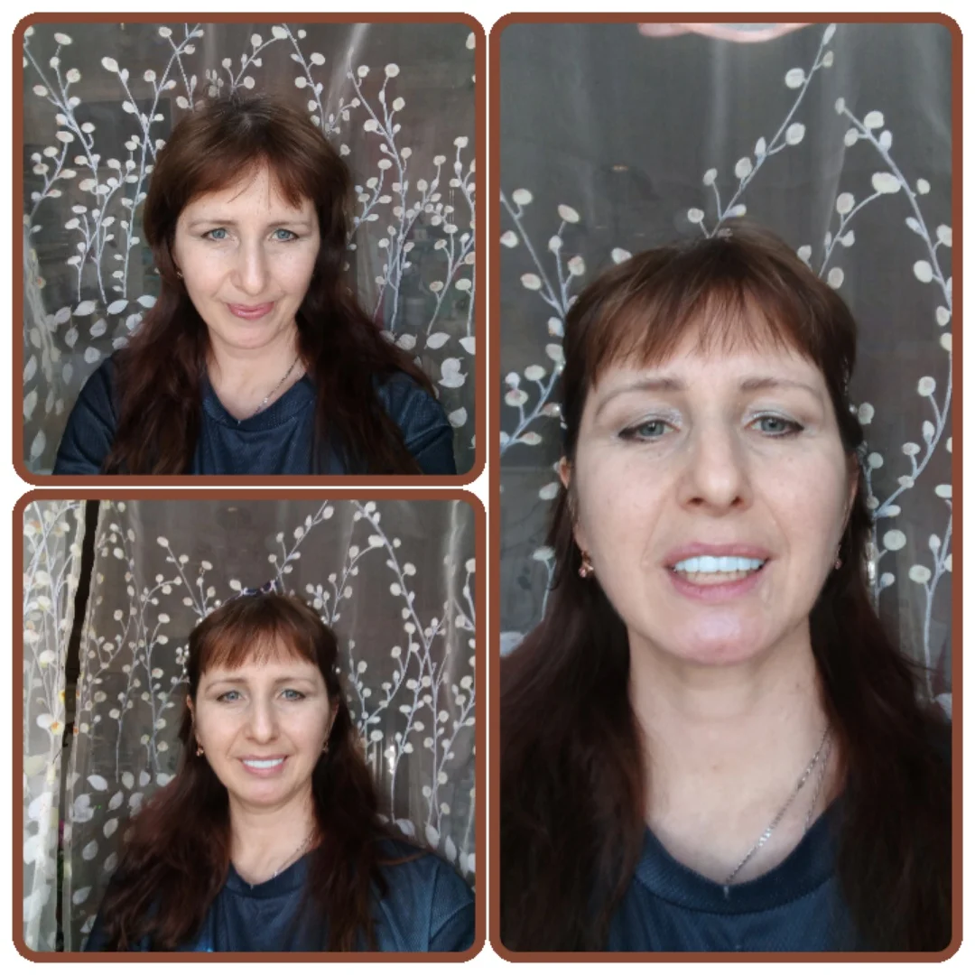 Snap On Veneers (Upper & Lower) - Top Quality Clip-On Veneers photo review